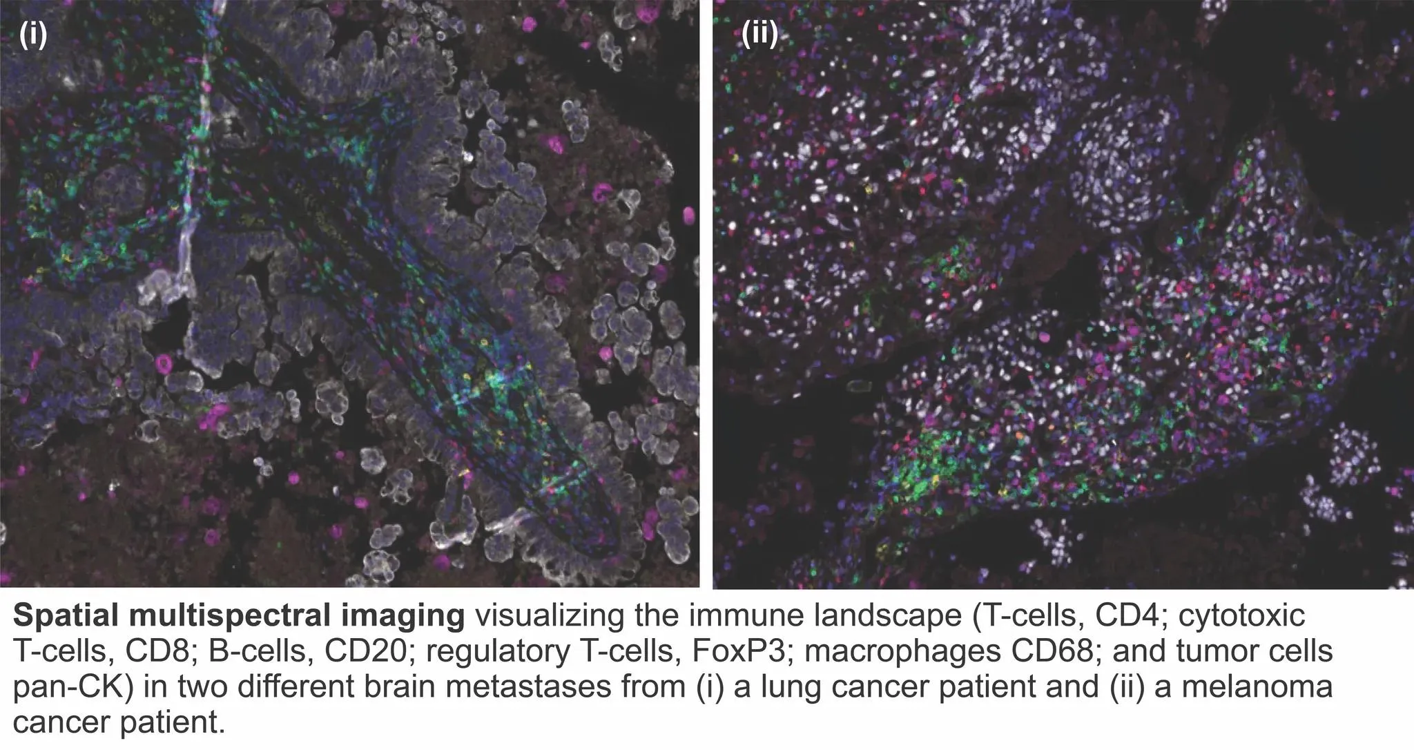 Spatial multispectral imaging